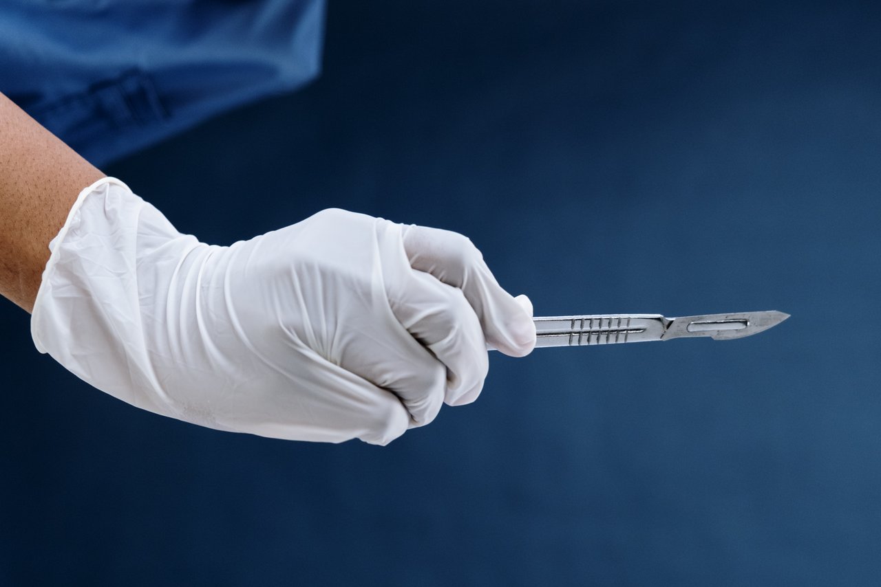 Hand met scalpel voor mannelijke vasketomie